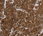 FASTKD1 Polyclonal Antibody