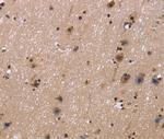 FASTKD5 Antibody in Immunohistochemistry (Paraffin) (IHC (P))