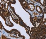 FASTKD2 Polyclonal Antibody