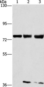 GGCX Antibody in Western Blot (WB)