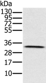 HSD17B8 Antibody in Western Blot (WB)
