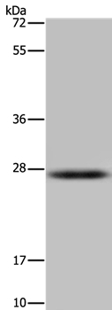 HSD17B14 Antibody in Western Blot (WB)