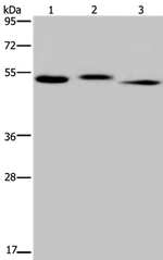 HYAL3 Antibody in Western Blot (WB)