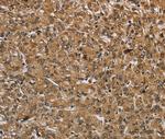 IKBIP Polyclonal Antibody