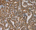 Importin 13 Polyclonal Antibody