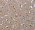 KLHL2 Polyclonal Antibody