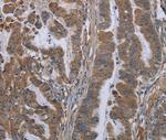 Kallikrein 8 Polyclonal Antibody