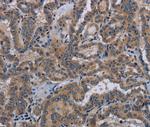 Kallikrein 8 Antibody in Immunohistochemistry (Paraffin) (IHC (P))