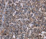 LDOC1 Polyclonal Antibody
