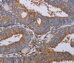 LIMS1 Polyclonal Antibody