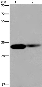 LIMS1 Antibody in Western Blot (WB)