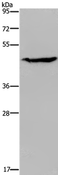 ACP6 Antibody in Western Blot (WB)