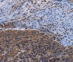 LRRC15 Antibody in Immunohistochemistry (Paraffin) (IHC (P))