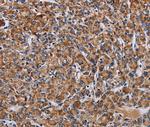 LRRC15 Polyclonal Antibody