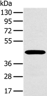 MAGEA10 Antibody in Western Blot (WB)
