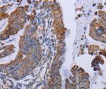 MT3 Polyclonal Antibody