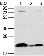 NDUFAF2 Antibody in Western Blot (WB)