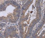 MKKS Polyclonal Antibody
