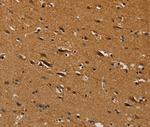 CENPU Antibody in Immunohistochemistry (Paraffin) (IHC (P))