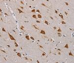 CMC4 Antibody in Immunohistochemistry (Paraffin) (IHC (P))
