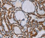 CMC4 Polyclonal Antibody
