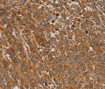 PLEKHG6 Antibody in Immunohistochemistry (Paraffin) (IHC (P))