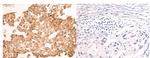 NDUFA2 Antibody in Immunohistochemistry (Paraffin) (IHC (P))