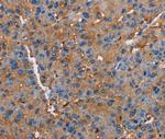 Neuroligin 1 Polyclonal Antibody
