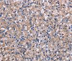 NIT1 Polyclonal Antibody