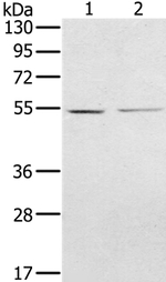 NMT2 Antibody in Western Blot (WB)