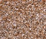 NOC2L Polyclonal Antibody