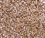 HMGN5 Polyclonal Antibody