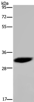 HMGN5 Antibody in Western Blot (WB)