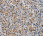 PNLIP Polyclonal Antibody