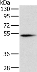 PNLIP Antibody in Western Blot (WB)