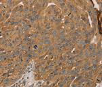 PARP11 Polyclonal Antibody