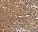 PARP11 Antibody in Immunohistochemistry (Paraffin) (IHC (P))