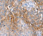 PLCZ1 Polyclonal Antibody