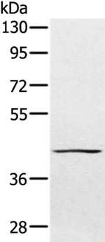 PTPN7 Antibody in Western Blot (WB)