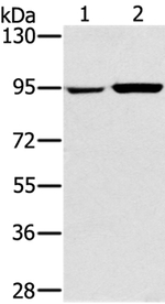 PYGL Antibody in Western Blot (WB)