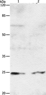 RAB8A Polyclonal Antibody