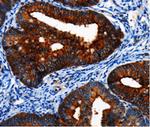 BRUCE Polyclonal Antibody