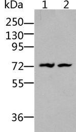 BDKRB2 Antibody in Western Blot (WB)
