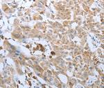 FGF1 Polyclonal Antibody