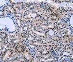 COX18 Polyclonal Antibody