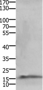 CMTM5 Polyclonal Antibody