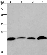 CMTM6 Antibody in Western Blot (WB)