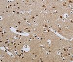 CMTM8 Antibody in Immunohistochemistry (Paraffin) (IHC (P))