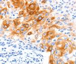 SLC2A11 Polyclonal Antibody