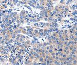 KCNH8 Antibody in Immunohistochemistry (Paraffin) (IHC (P))